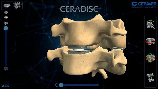 Application tactile — CERADISC Application de présentation